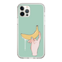 スリムプロテクションケース［ そんなバナナ ］